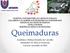 Queimaduras. Acadêmico: Melissa Dorneles de Carvalho Orientador: Dr. Marcos Cristovam Cascavel, novembro de 2015