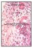 Análise da reação do tecido subcutâneo de ratos à implantação de pastas de hidróxido de cálcio associadas a diferentes substâncias