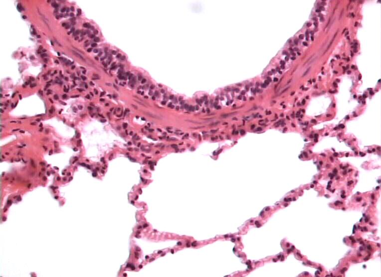 Bronquíolo olo propriamente dito Ausência de cartilagem, glândulas ou nódulos linfáticos Mucosa - Ep.