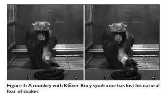 1939 Klüver e Bucy: lesões no lobo temporal envolvendo amígdala e hipocampo influenciavam profundamente as respostas afetivas em primatas (docilidade, hipersexualidade indiscriminativa e traziam