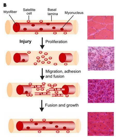 Fase de regeneração: ocorre fagocitose do tecido lesionado para remoção dos debris celulares.