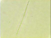 (Abril 2002) Figura 32 - Botriococcus sp (1000x)