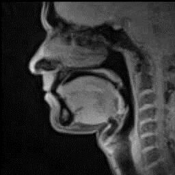 3. APARELHO FONADOR O sistema articulatório