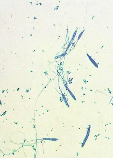 Gênero Microsporum 18