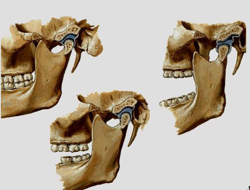 Articulações temporo mandibulares Anatomia: Mandíbula (porção vertical, processo coronóide, côndilo mandibular, cavidade glenoide).