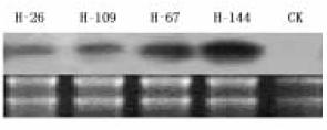 , 2005 Lisozima cliva β(1-4) glicosidica Peptidoglicano (Bactérias) Quitina (Fungos)