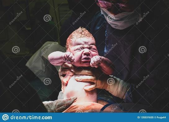 PERÍCIA DO INFANTICÍDIO Logo ao nascer (infante nascido) Acabou de nascer, respirou, mas não recebeu nenhum cuidado especial Tem o corpo coberto por