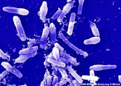 Gênero Bacillus Bacillus cereus Encontrados no solo Não fazem parte da microbiota humana normal?