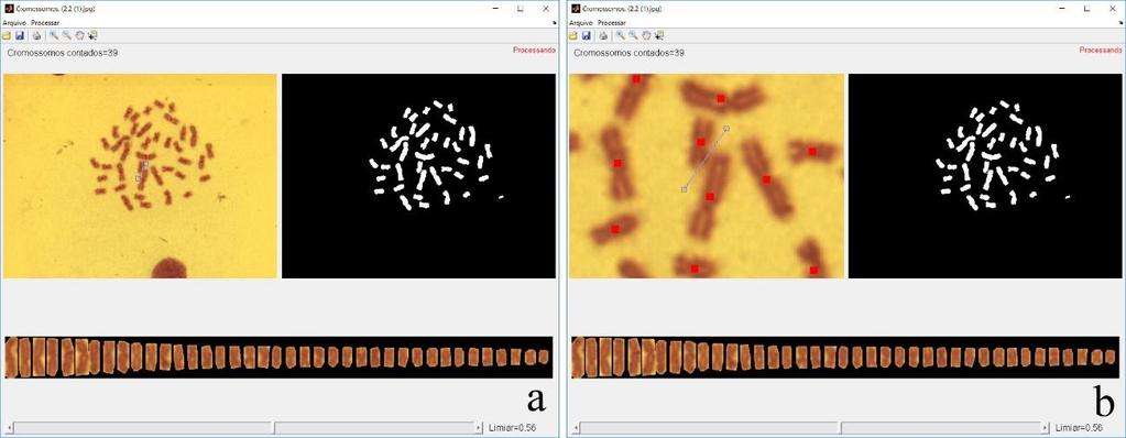 Montagem de cariótipos... Figura 3. Separação dos cromossomos muito próximos, (a) linha e (b) linha com aplicação de zoom.