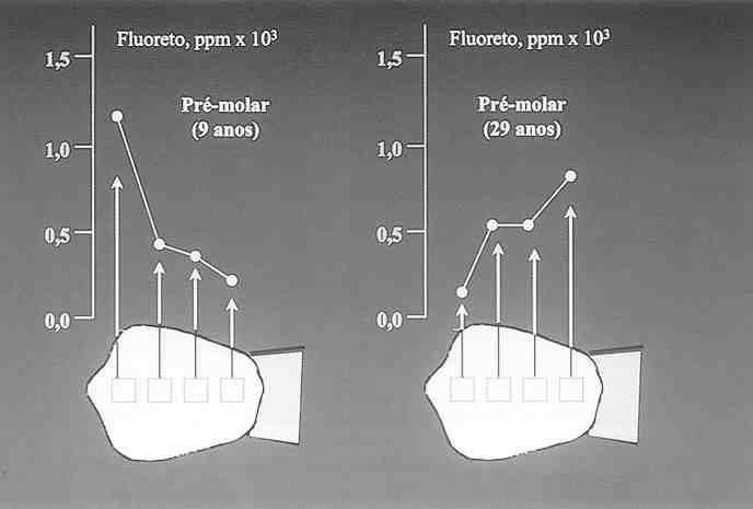 Fluoreto: reduz o ph crítico no qual ocorre a solubilização da HA ( liberação de íons Cálcio e Fosfato). D.