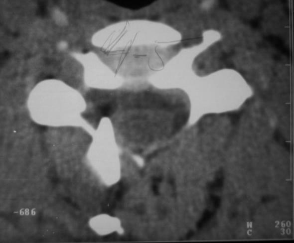 Coluna vertebral Para