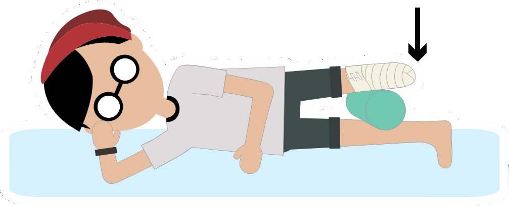 2- Deitado de lado e com perna esticada, realize o movimento de subir e descer o coto por 10 vezes.