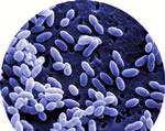 Infecções Pneumocócicas (Streptococcus pneumoniae) Bactérias gram positivas dispostas em cachos e encapsuladas Existem atualmente descritos 92 sorotipos