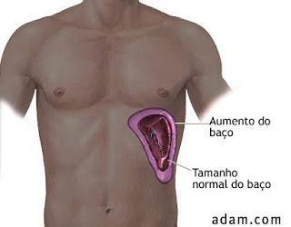 Sistema Linfático Baço: Cemitério de Hemácias O baço também tem participação na resposta imune, reagindo a agentes infecciosos.