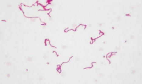 Peste bulbônica ou peste negra - Yersinia pestis Bastonete Gram negativo enterobactéria É uma doença primariamente de roedores como ratos, coelhos, esquilos, dentre outros e outros animais (gatos e