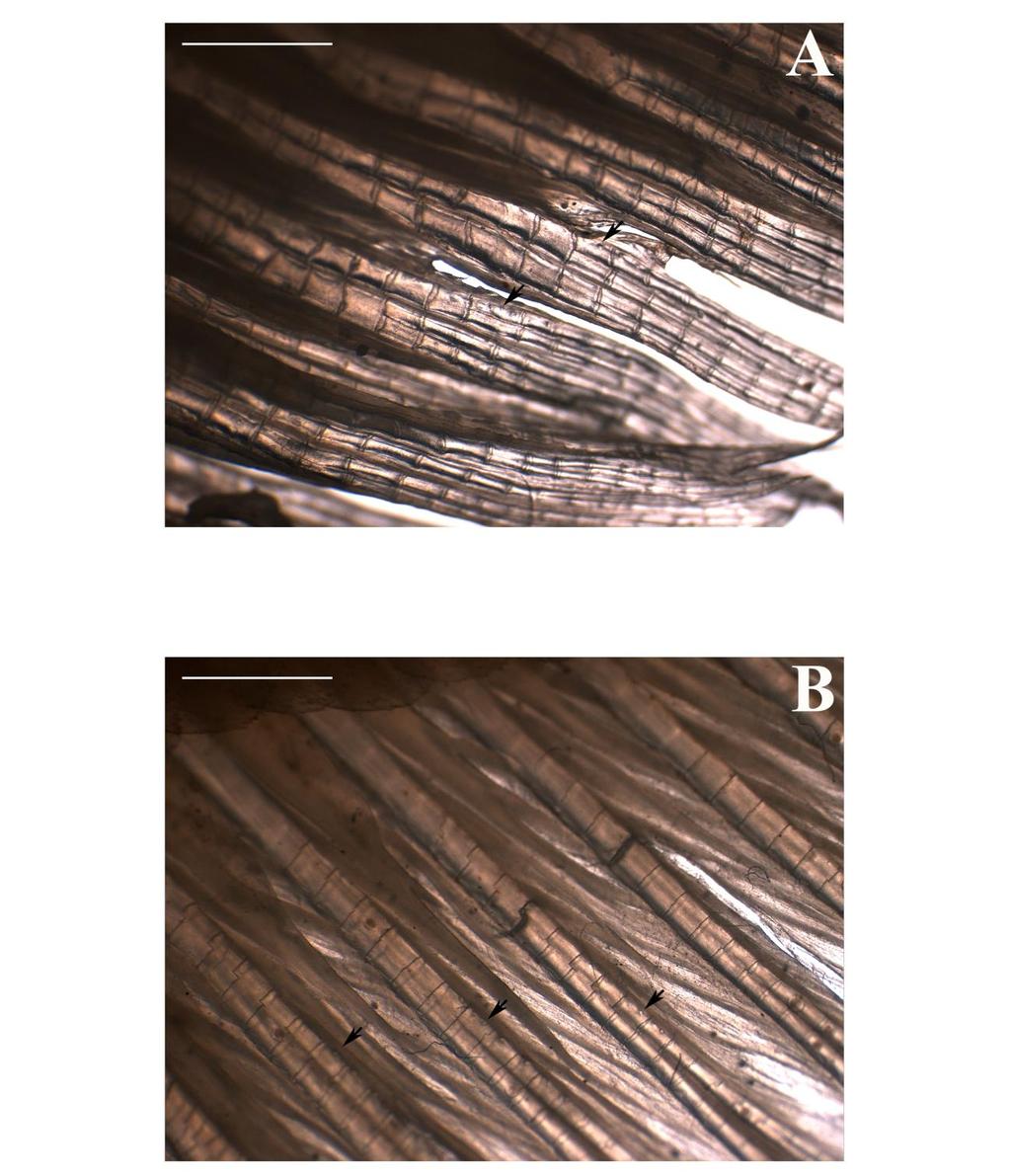 Figura 20 Vista lateral dos raios anteriores da nadadeira anal de fêmeas de (A) Galeocharax humeralis MZUSP 90473,