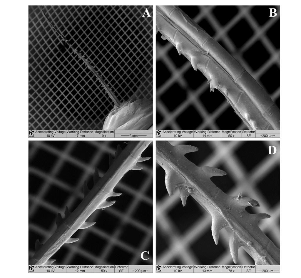 Figura 36 Micrografias de varredura do segundo raio ramificado da nadadeira anal de um macho de Galeocharax gulo MZUSP 40901, 110,6mm CP.