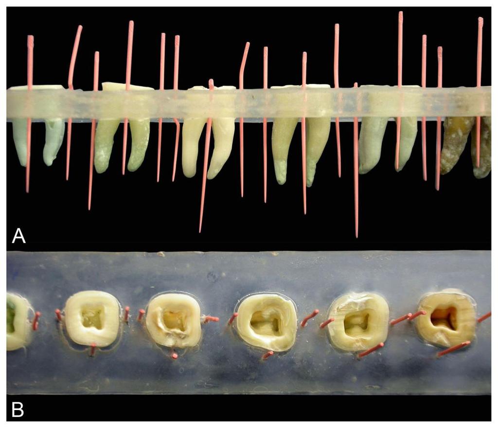 - 50 - Material e Métodos Figura 4 Base de acrílico com os dentes incluídos e marcação com guta percha.