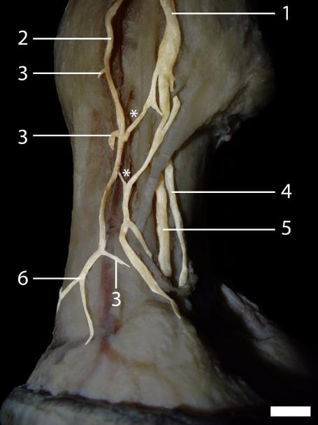 Membro torácico, face me- Figura 2. Membro torácico, face medial.1) Nervo palmar medial;2)ramo dial.