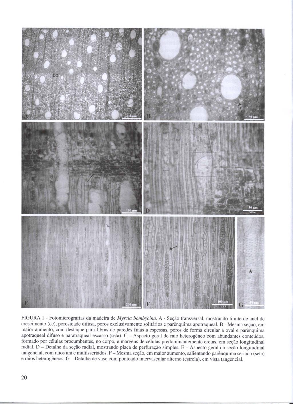 FIGURA I - Fotomicrografias da madeira de Myrcia bombycina.