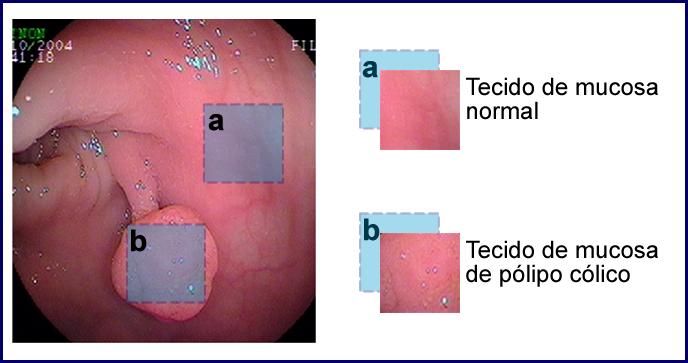 texto de dados do tipo imagem, essa análise pode ser realizada por meio de uma interação entre as áreas de Análise de Imagens AI e de Inteligência Computacional IC, que consiste, primeiramente, na