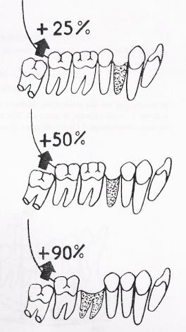 45 com a extração do primeiro molar inferior esta possibilidade vai para 90% com um aumento máximo posterior de 8-10 milímetros de cada lado da arcada (figura 25).