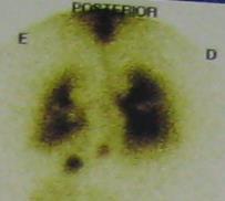 Ecocardiograma: