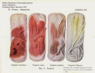 PERÍCIA DO PARTO NA MULHER VIVA Parto recente Lóquios secreção que escoa dos genital, com aspecto sanguinolento