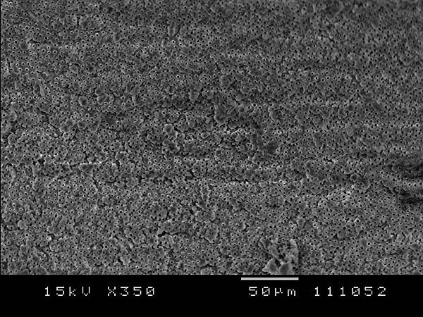 10Hz Figura 19 - Fotomicrografia eletrônica de varredura da porção média do canal radicular após a