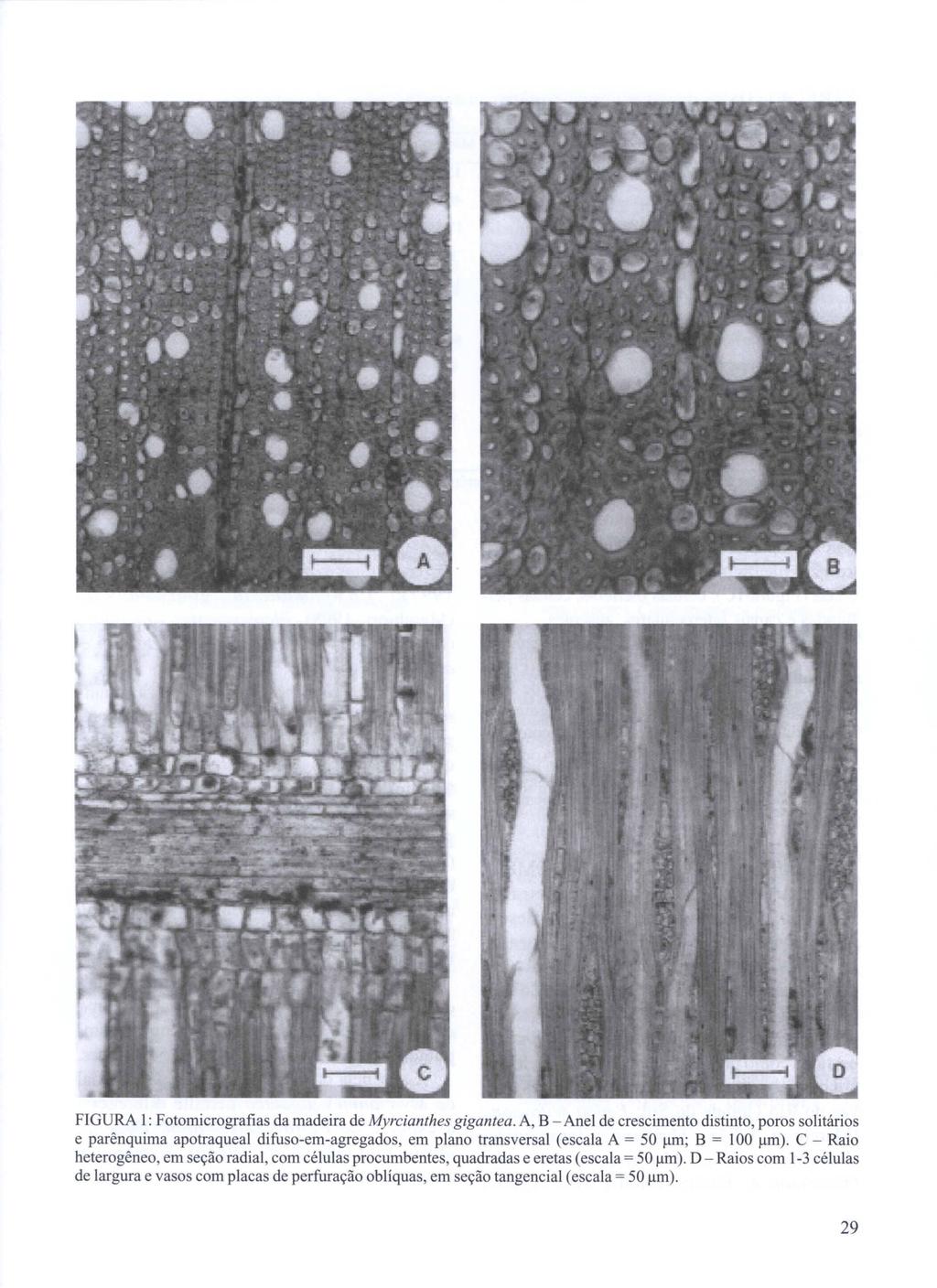 FIGURA I: Fotomicrografias da madeira de Myrcianthes gigantea.