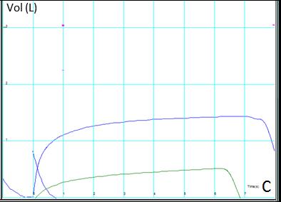 Volume curves Volume x Time curves B 4 PEF Seated Supine 2 4 6 Vol