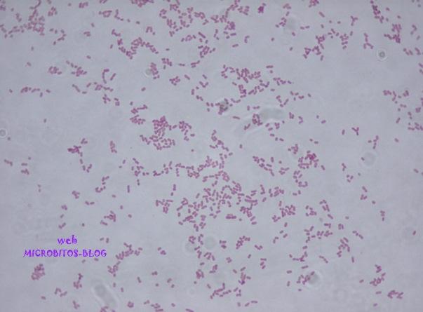 16 4.1.2. Klebsiella pneumoniae Estas bactérias são bacilos Gram-negativos de natureza anaeróbia facultativa. São imóveis, não esporuladas e possuem cápsulas polissacarídicas (CABRAL, 2011).
