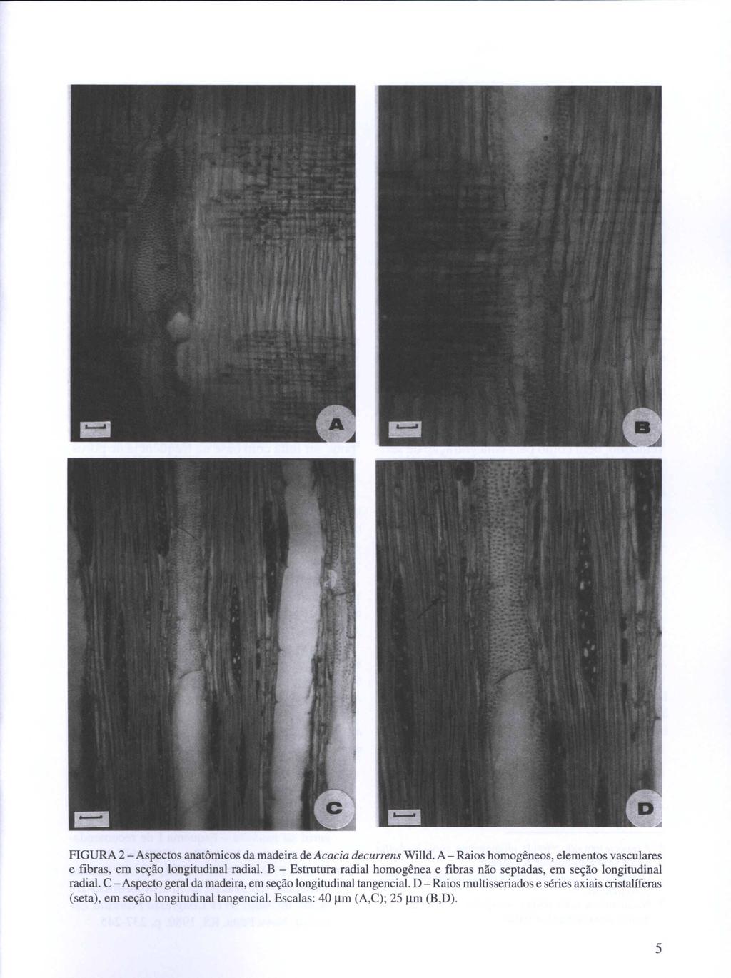 FIGURA 2 - Aspectos anatômicos da madeira de Acacia decurrens Willd. A - Raios homogêneos, elementos vasculares e fibras, em seção longitudinal radial.