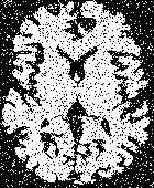 61 A B C Figura 28: Exemplo de aplicação de um MRF para redução de ruído em uma imagem binária: original (A), ruído adicionado, invertendo-se 10% dos pixels (B) e ruído reduzido com MRF (C).