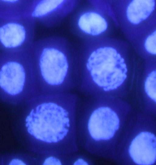 Outra avaliação utilizada para mensurar a genotoxicidade é a frequência de aberrações cromossômicas encontradas nas células de A.