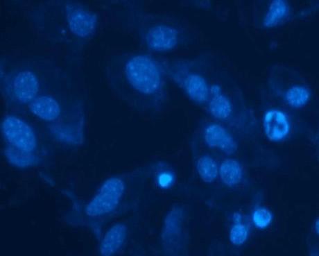 valores de micronúcleo juntamente com o ponto L2 logo a montante do L3 (Figura 26). Figura 25. Micronúcleo encontrado em célula C2C12 binucleada. Fonte: Autoria própria.