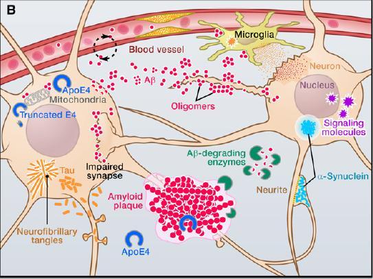 indicando que as vias de sinalização da insulina poderão ter um papel importante na patogénese da doença. [4] 3.