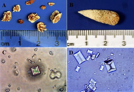 10 Figura 1 - Imagens de urólitos e cristais de oxalato de cálcio e estruvita.