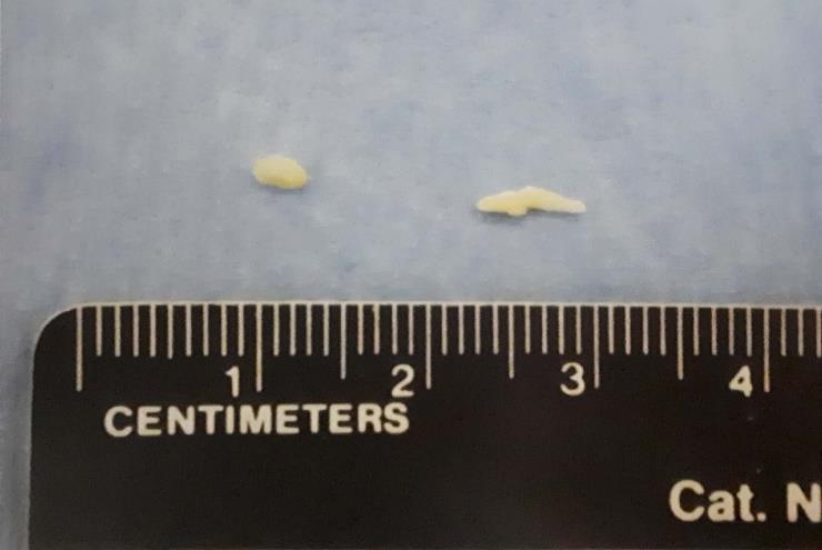 11 Figura 2 - Representação de tampão uretral de gato. Tampão uretral de matriz proteinácea e estruvita removido de gato macho com obstrução uretral.