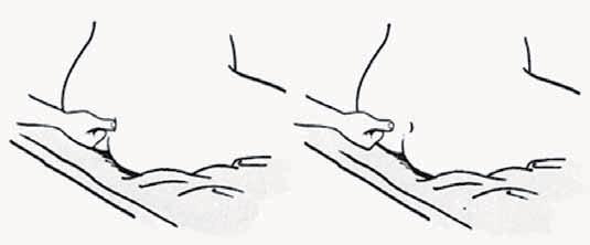 Ministério da Saúde Secretaria de Atenção à Saúde Departamento de Atenção Básica Na região sacra: Posicione a gestante em decúbito lateral ou sentada; 104 Pressione a pele, por alguns segundos, na