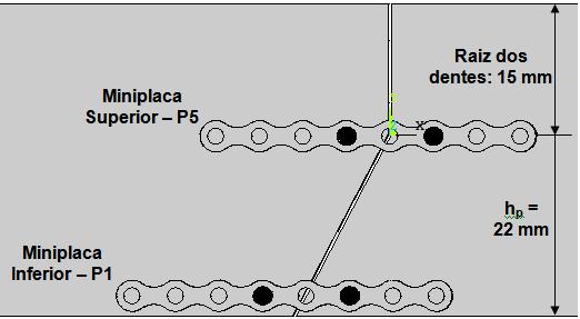 posições P3P1, P5P1 e P5P3, que são estatisticamente iguais por apresentarem o mesmo nível de significância (neste exemplo, existem outras configurações, além destas citadas com a mesma