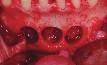 Sociedade Portuguesa de Periodontologia e Implantes (SPPI) Prática exclusiva em Periodontologia e Implantes Alexandre Miguel Santos Médico