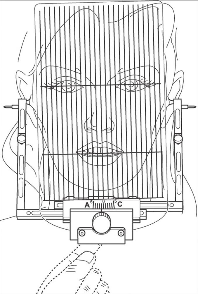 2 Aplicação no paciente Para a determinação do ângulo estético, é necessário que o paciente e o dentista estejam face a face.