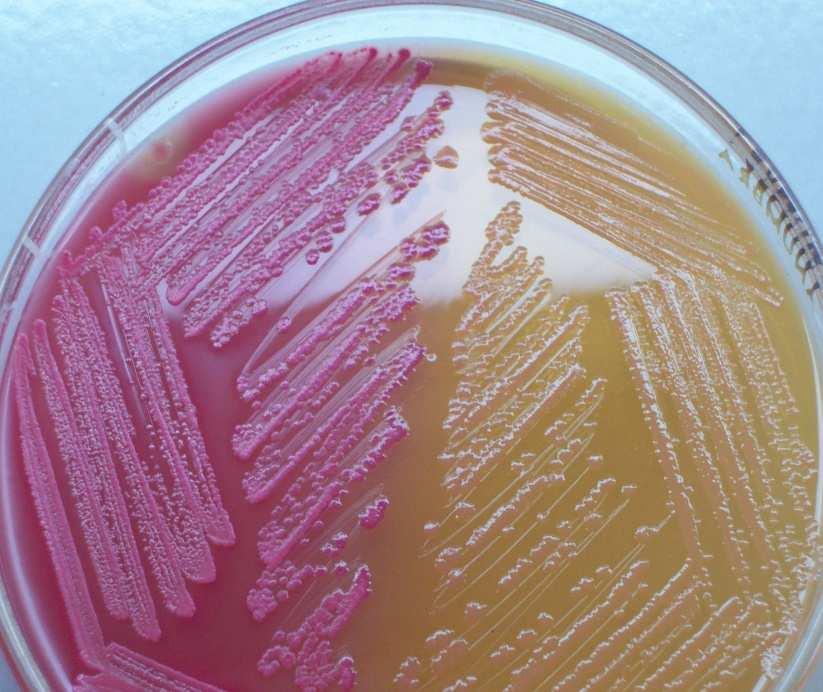 crescimento e multiplicação de bactérias e fungos em laboratório; * na indústria