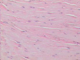 51 A B FIGURA 16 Aspecto histopatológico do tendão de rato do Grupo III, lado E (3 dias após a injeção de solução fosfato).