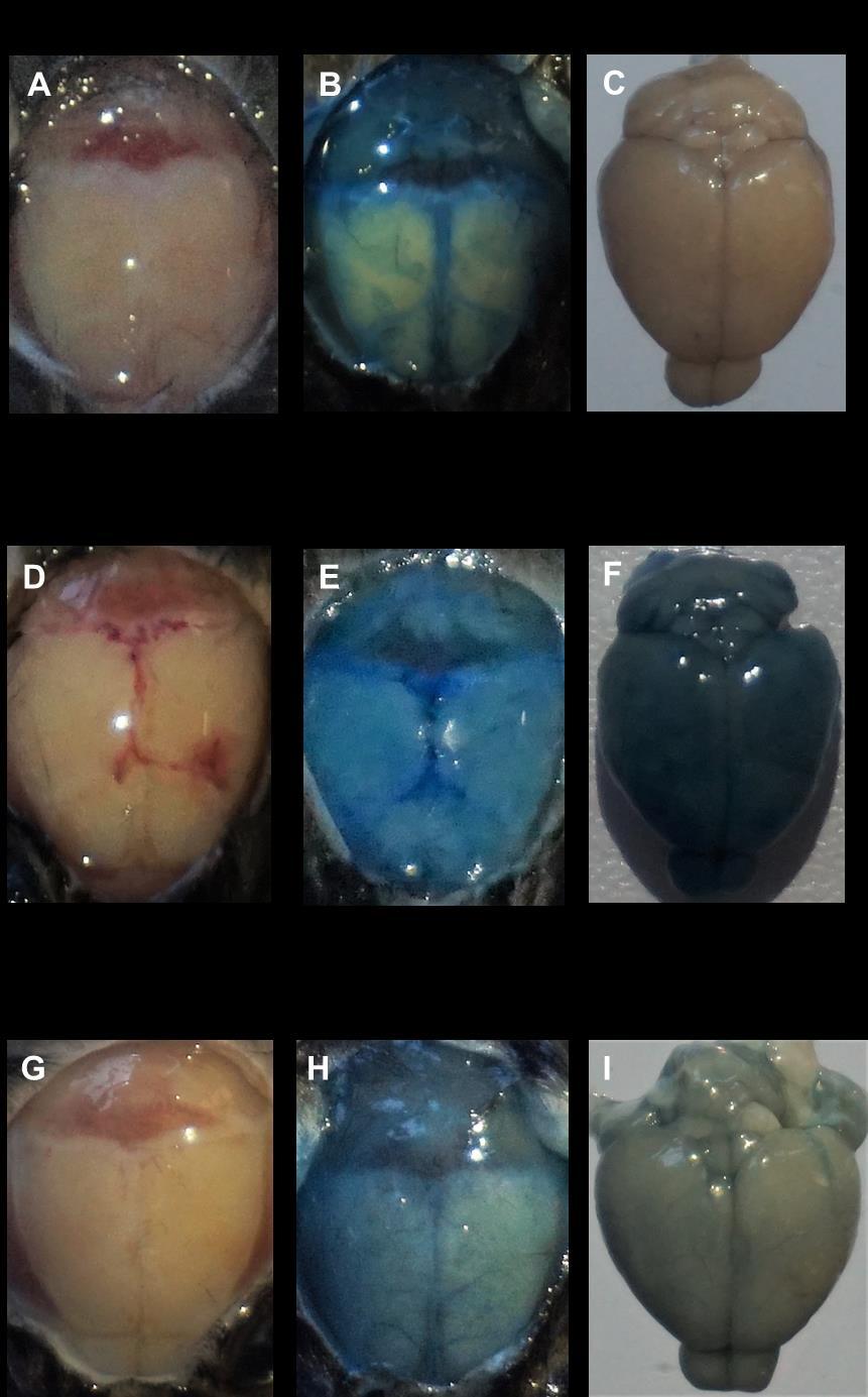 Figura 11: Fotografias macroscópicas do cérebro dos animais que desenvolveram quadro de malária cerebral e hiperparasitemia.