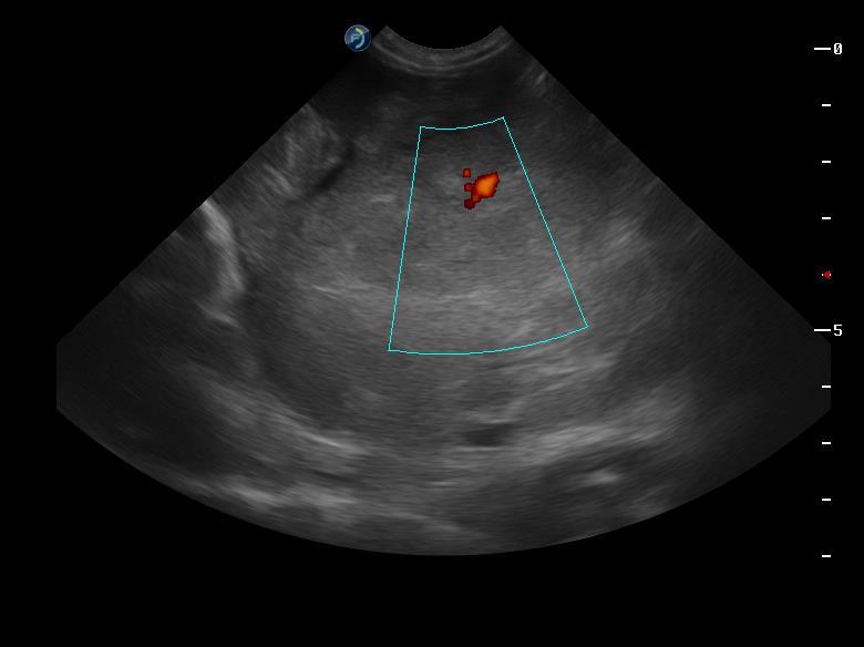 26 Figura 5: Imagem ultrassonográfica de fígado de cão, com dimensões aumentadas, ecotextura heterogênea