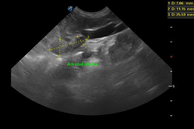 A B Figura 6: Imagem ultrassonográfica de adrenais esquerda e direita respectivamente de cão,