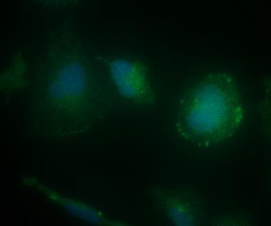 9- Fluorescence intensity of the autophagic marker LC3 in CHME3 microglial cells is reduced after 24 h