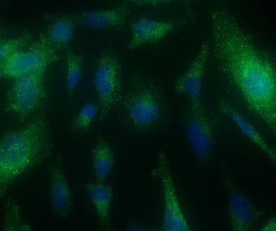 CHME3 microglial cells were incubated with SH-SY5Y and SH-SY5Y APPSwe-derived exosomes, as described